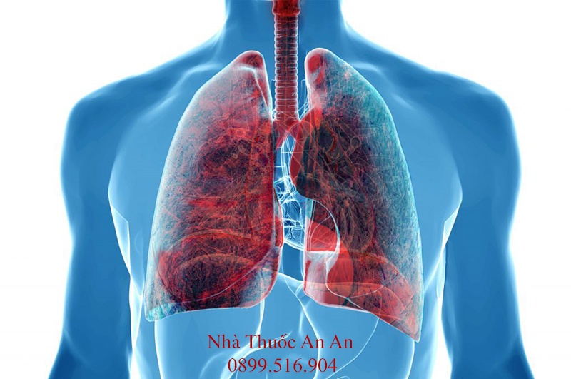 Ung thư phổi là gì? Triệu chứng và phương pháp điều trị bệnh